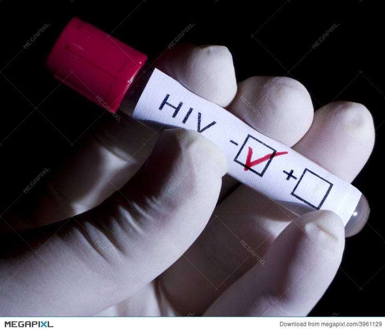 Umuntu wakane ku isi yakize Sida