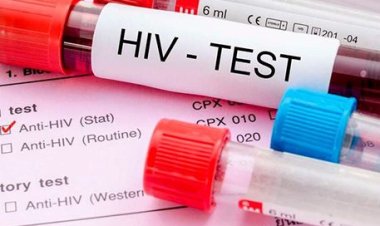 Ibiciro by'umuti wa Sida byashyizwe ahagaragara.