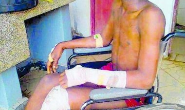 Umunyeshuri yakubiswe na mwalimu bimuviramo gukomereka azira kwiba Amandazi ane