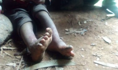 Musanze: Nyakatsi yo kuburiri intandaro y'amavunja adacika kubasigajwe inyuma n'amateka