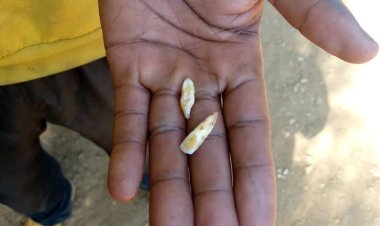 Kigali: Umugore yakubise Umugabo we amukura amenyo abiri